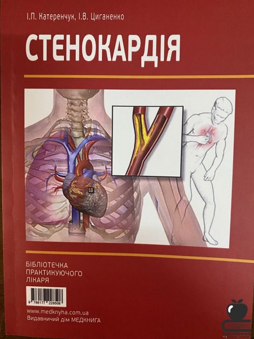 Стенокардія