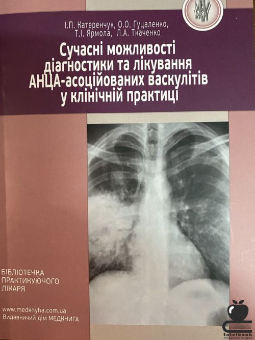 Сучасні можливості діагностики а лікування АНЦА- асоційованих васкулітів у клінічній практиці