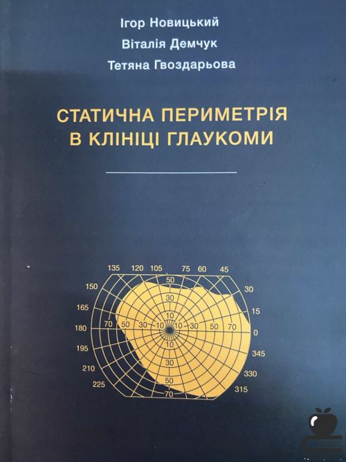 Статична периметрія в клініці глаукоми