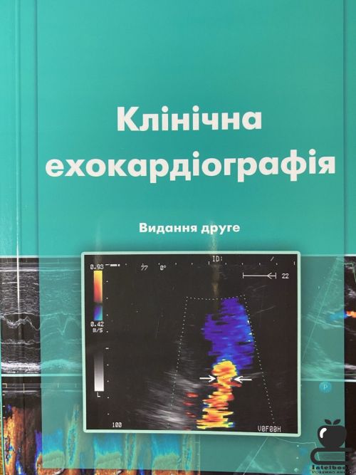 Клінічна ехокардіографія