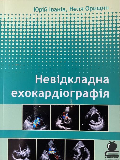 Невідкладна ехокардіографія