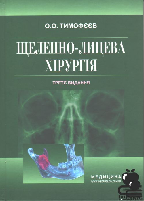 Щелепно-лицева хірургія. Підручник